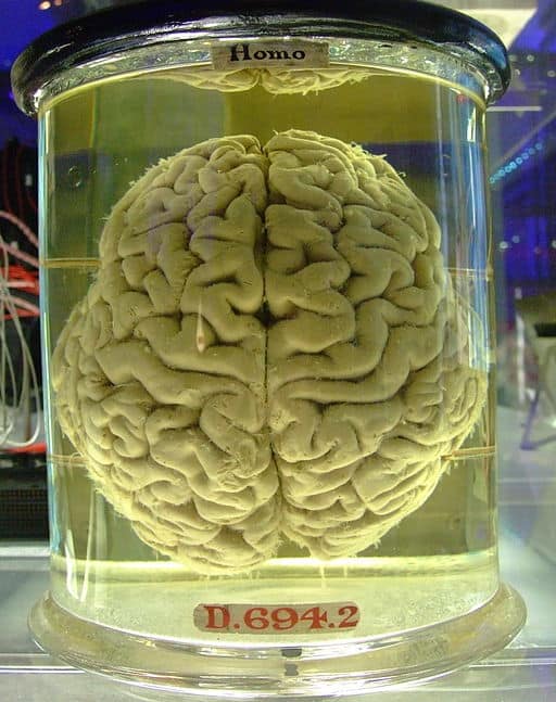 Human brain in a clear liquid